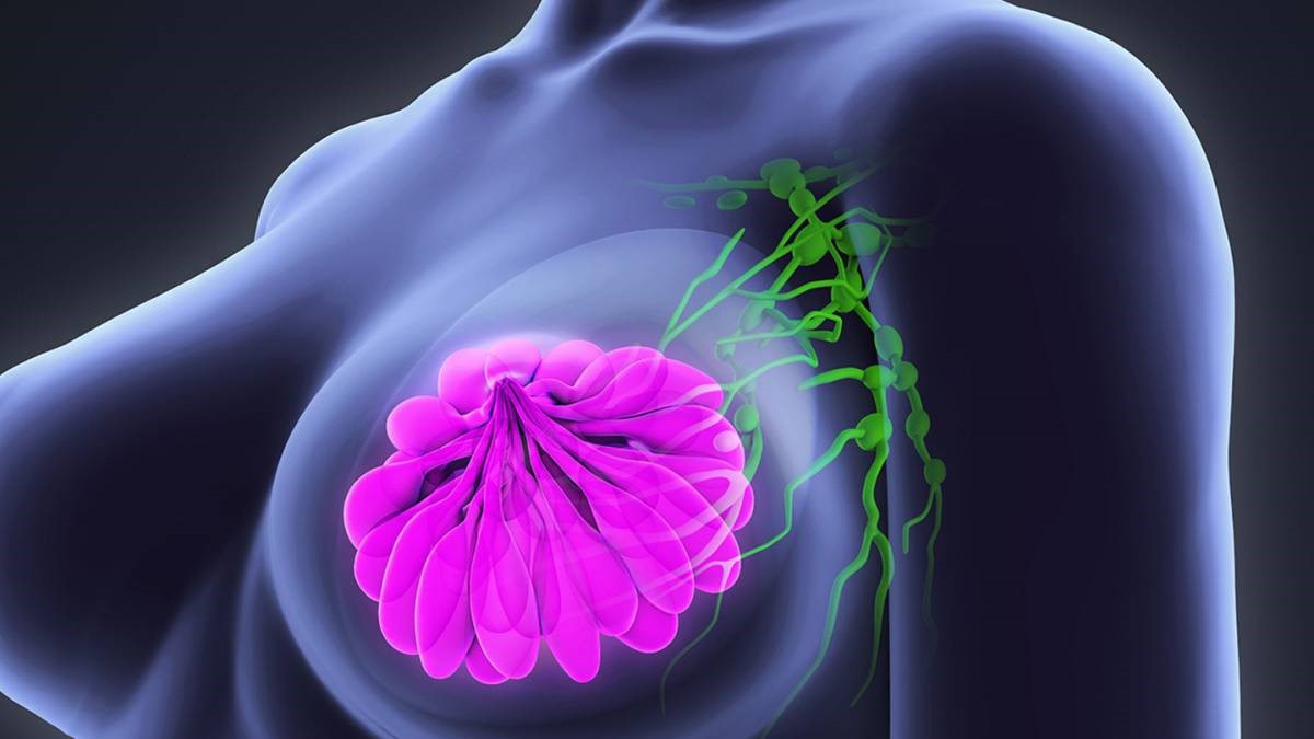 “Ya es hora”: mujeres hacen llamado a la prevención y detección temprana del cáncer de mama.alt 