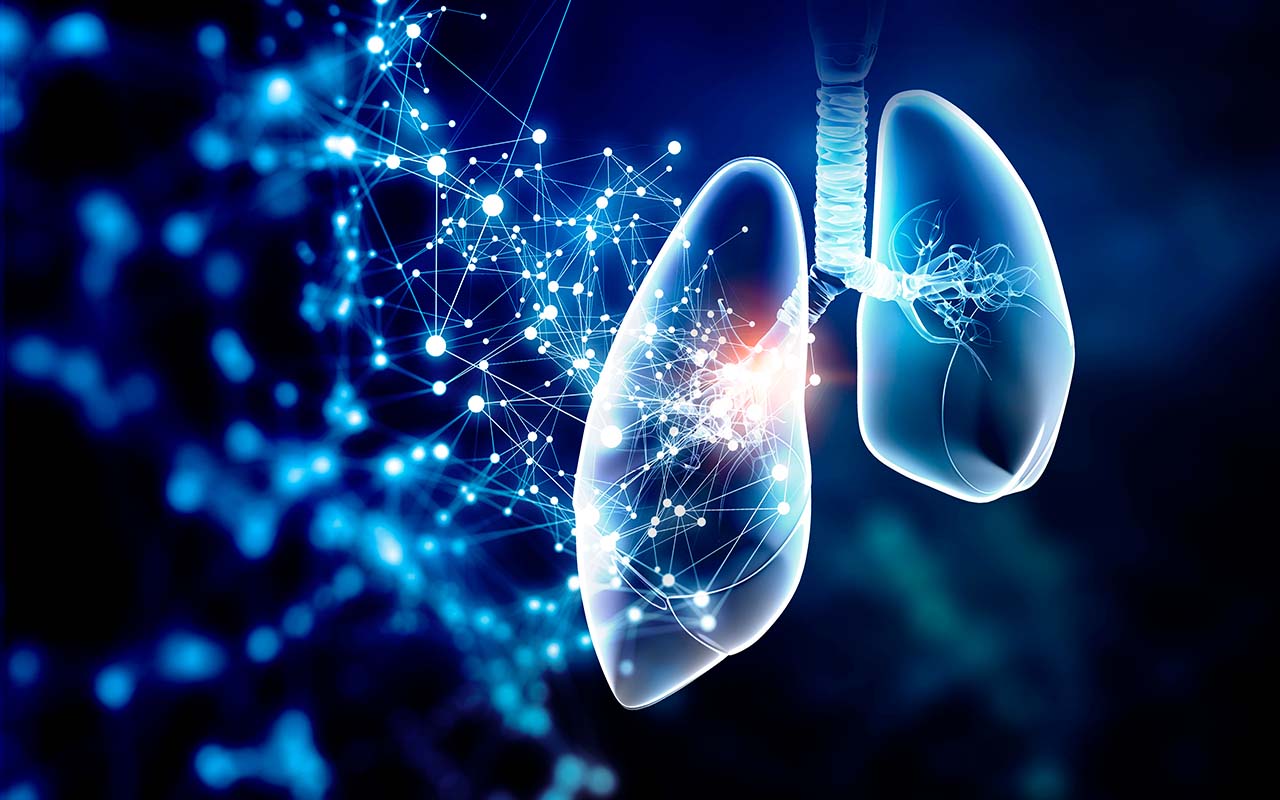 Investigación busca identificar necesidades y barreras de los pacientes con cáncer de pulmón en el país.alt